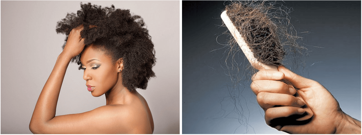 Traitement anti chute de cheveux peaux noires